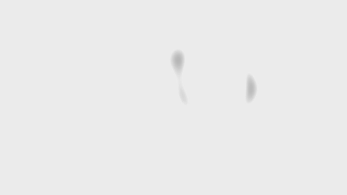 TCR Style Tuning Dry Carbon Fiber Front Strut Tower Top Brace Bar For FL5 Honda Civic Type R (2023–2025) NexaNovo